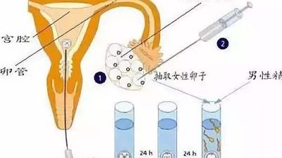 试管婴儿成功日记怎么写才有参考价值？三个真实步骤