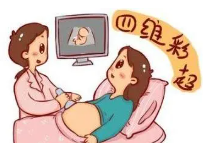 做四维需要做什么准备