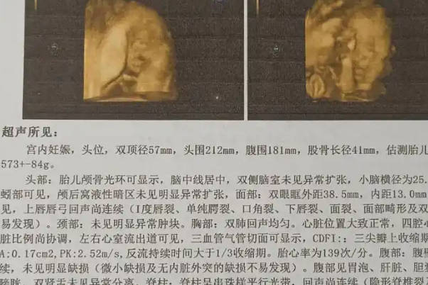 已经生了女宝宝的妈妈们能否分享一下四维彩超单子呢？