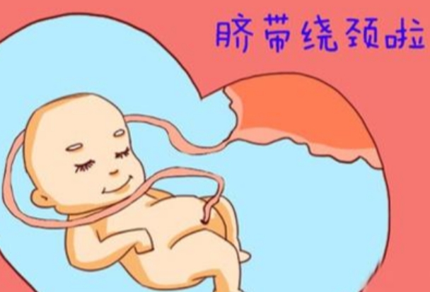 通过超声检测可以查看是否脐带绕颈