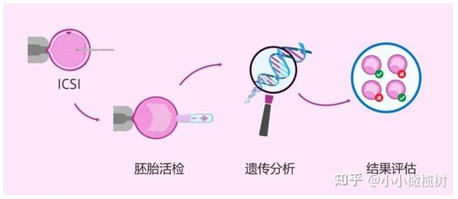 北医三院试管流程时间表有多长?从挂号到验孕的真实耗时