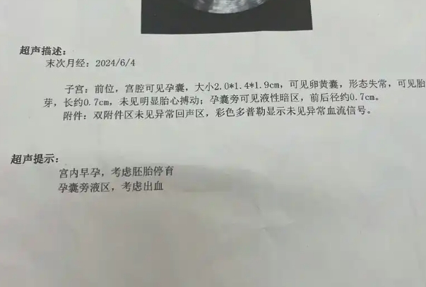 胎停孕囊送检有助于查找原因