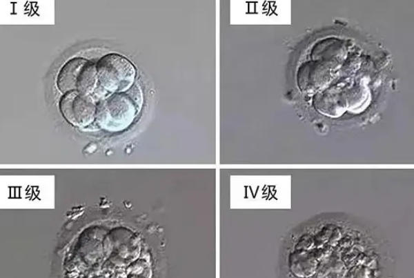 胚胎的等级会影响试管成功率