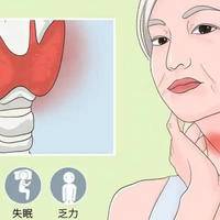 甲状腺结节最怕三种运动，科学解析与安全指南