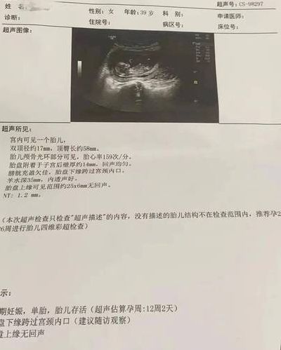 卵泡长得不圆就是质量不好吗？34岁备孕两年，B超单终于有了答案