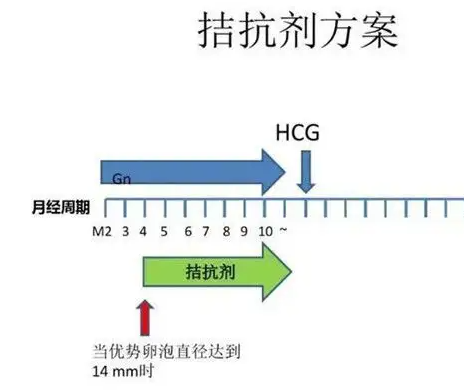 试管拮抗剂方案是一代还是二代