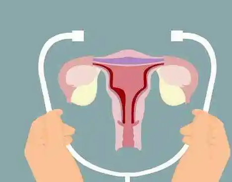 子宫内膜异位症适合做第一代试管技术怀孕吗？