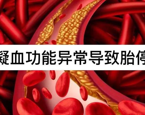 试管婴儿哪些人不用打肝素？看凝血、出血风险和病因
