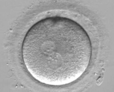 试管受精卵没有形成胚胎是什么原因？无胚胎形成和什么关系最大！