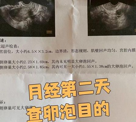 月经量少会不会影响试管的成功率？关键看内膜和卵泡