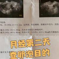 月经量少会不会影响试管的成功率？关键看内膜和卵泡