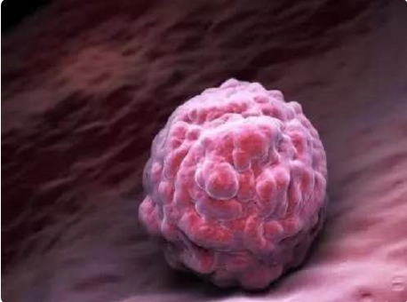 移植胚胎需要看年龄条件