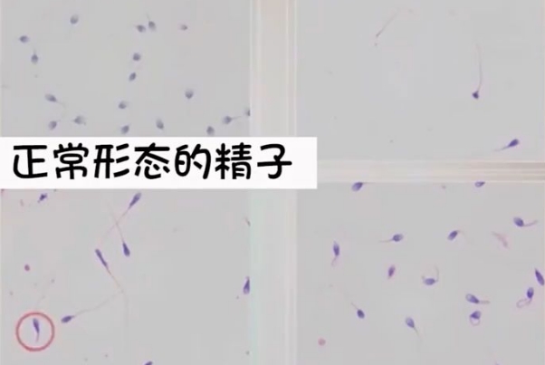精子畸形率高不等于生育能力差