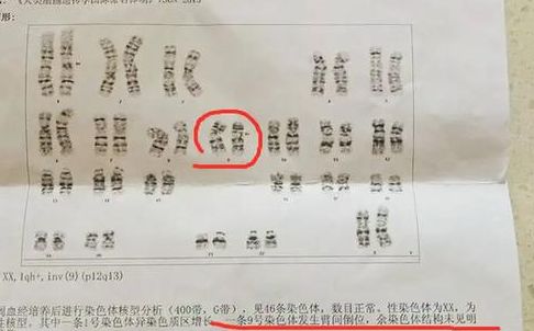 查染色体挂什么科？生殖科管_怀不上_，遗传科查_传不传_，选错白跑一趟