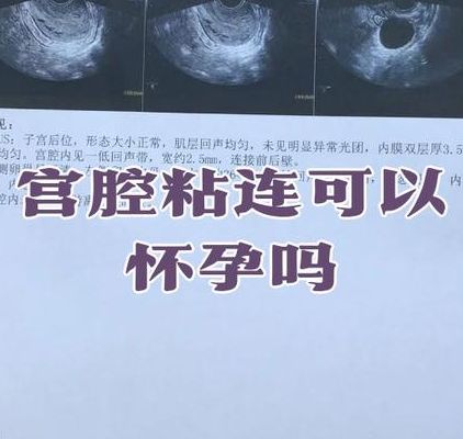宫腔粘连做试管成功率高吗？先解决这件事再进周