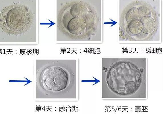 试管养囊是不是很难？多少钱？过来人梳理5笔费用价格明细