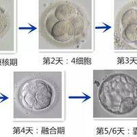 试管养囊是不是很难？多少钱？过来人梳理5笔费用价格明细