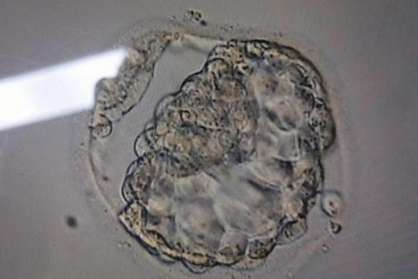 剖腹产可以移植冻囊胚