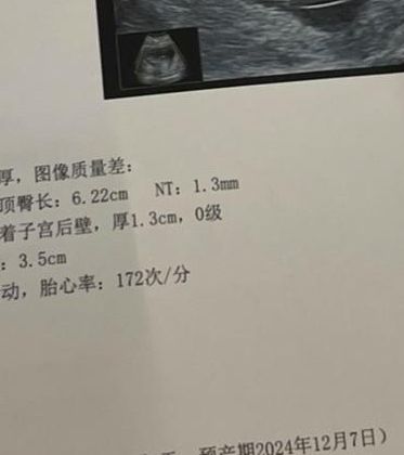 第三代试管让我34岁排名靠前次听到胎心，前两次失败都卡在同一个环节