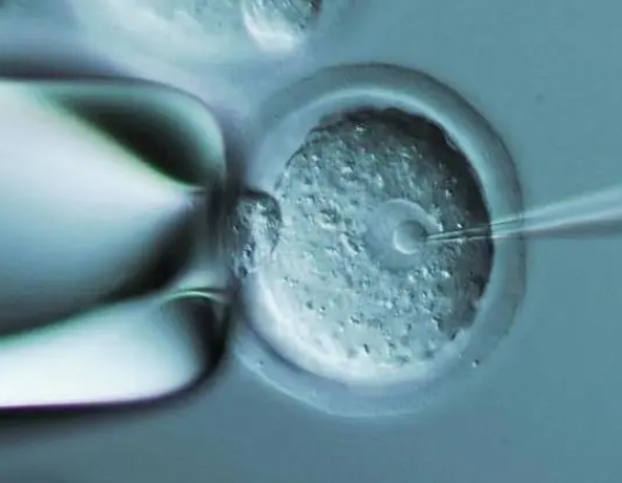 鲜胚成功率受多因素影响