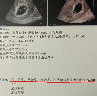 试管婴儿双生子和单胎价格一样吗？多少钱？过来人帮你梳理费用明细