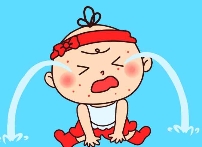 婴儿湿疹要好好护理