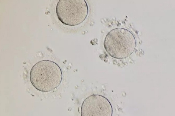 15mm大的卵泡也有可能培育出胚胎