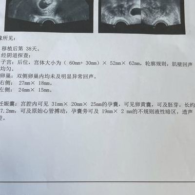 试管中心跑了快两年，我终于听到了那句_恭喜你_