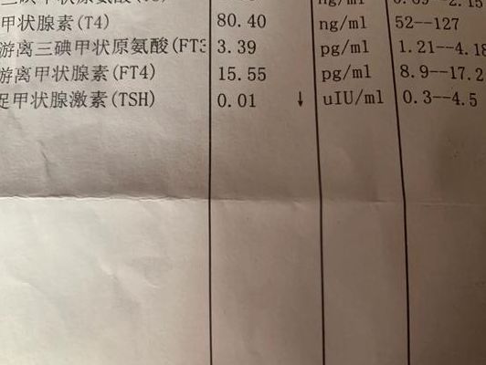 促甲状腺素低至0.01严重吗？光看这一个数字还真定不了罪