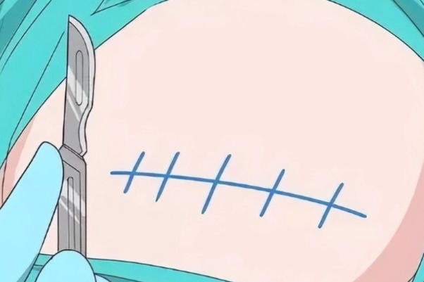 医院等级会影响剖腹产费用