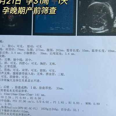 做完小排畸的下一次产检，真正的主角换人了