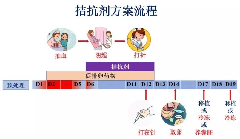 拮抗剂方案只是试管方案