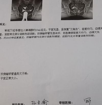 通而不畅怀孕几率大吗？能怀，但赌的是两件事