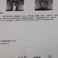 通而不畅怀孕几率大吗？能怀，但赌的是两件事