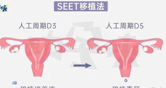 试管婴儿济南医院排名优质,我试管成功率高的真实经历