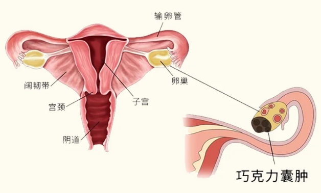 巧囊打三针和六针效果