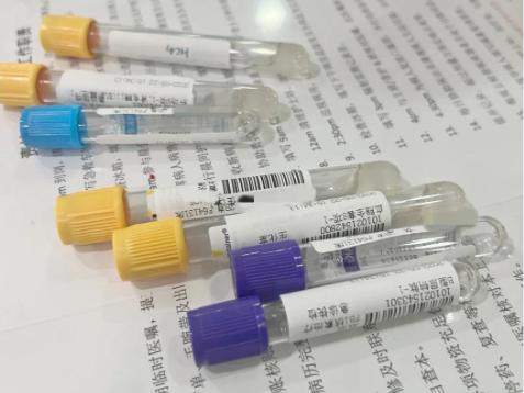 碘131治疗甲亢有副作用