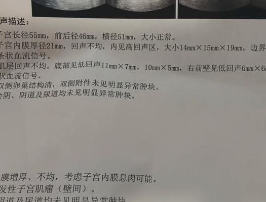 试管不成功的原因有哪些原因？胚胎质量只是排名靠前步