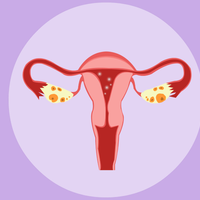 女性子宫腺肌症怎么治最好，药物、手术治疗都可以