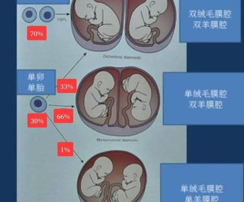 试管移植两个胚胎男女双胎几率：和单胚胎移植PK，哪个更现实？