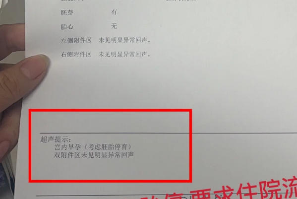 无胎心可能是自然筛选