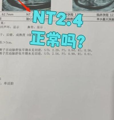 试管婴儿怀孕后几个月才算稳定？看NT检查过关还是看孕反消失