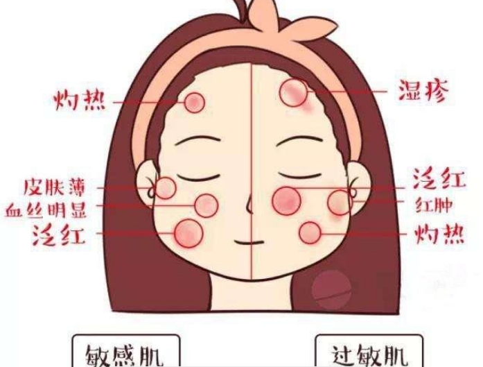 孕期过敏不吃药能扛过去 孕期过敏不吃药能扛过去