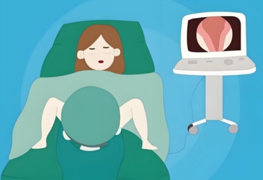 试管移植前宫腔灌注HCG