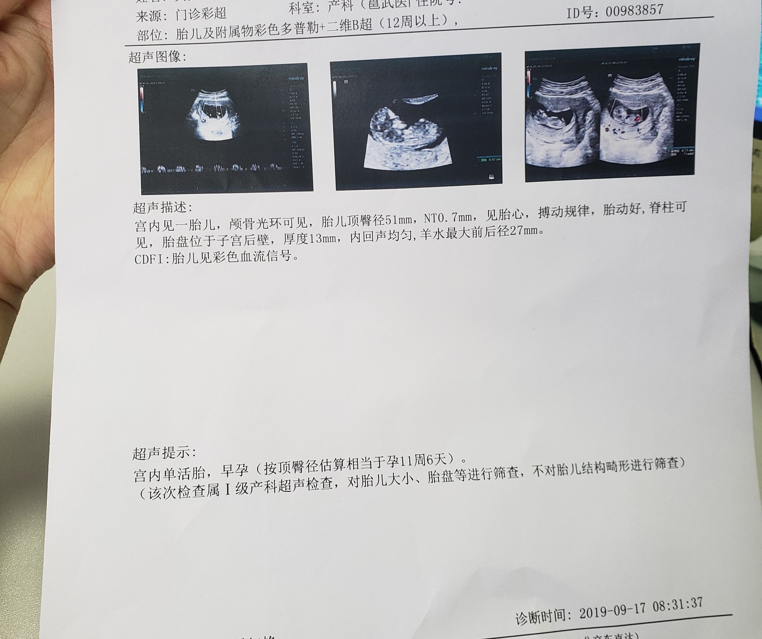 965eba35-9921-4f6e-9585-1490d68ae796