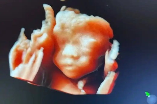 公立医院禁止做四维