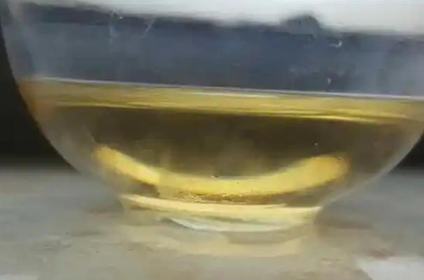 尿液颜色与胎儿性别无关