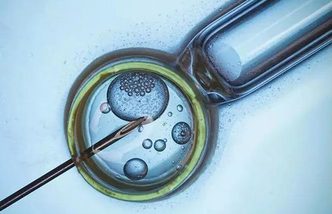 做宫腔镜费用有差异