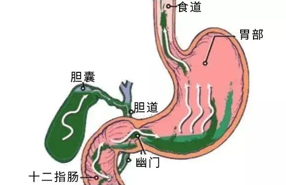 胆囊不舒服影响试管移植吗?胆囊疾病不一定影响试管