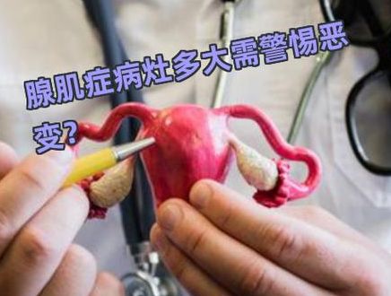 子宫腺肌症可以做试管婴儿吗？先看子宫大小和病灶类型再决定
